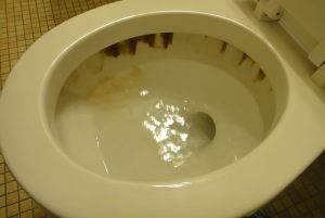 How to Remove Toilet Stains Brown